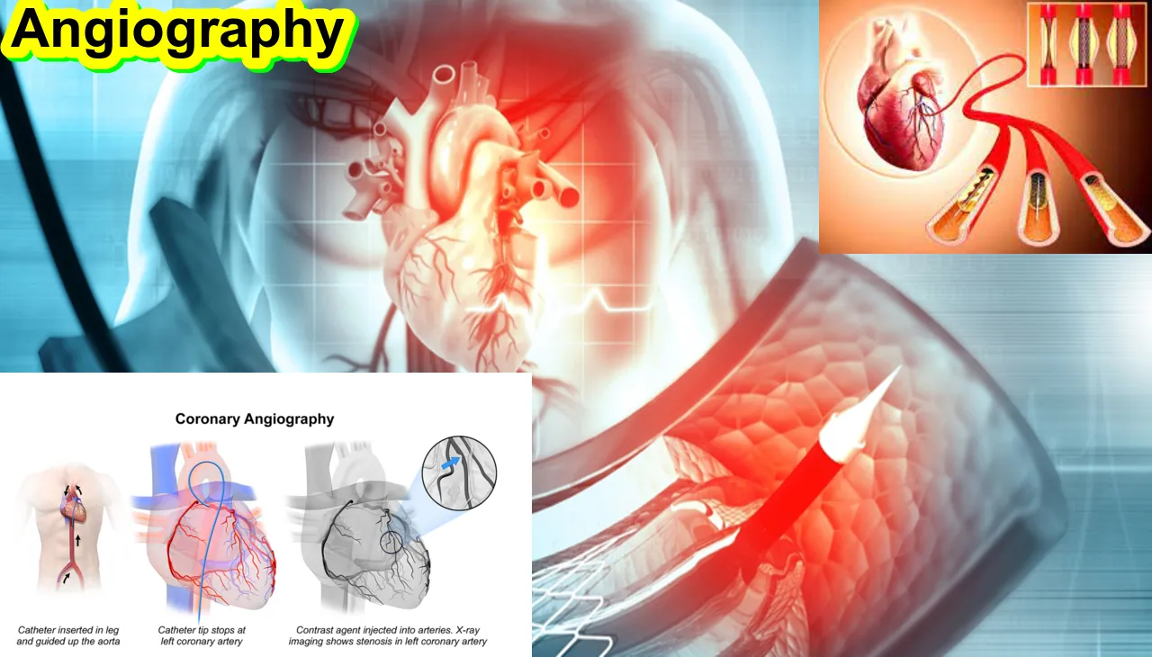 How to Work Angiography & What is Angiography, Best Producer24