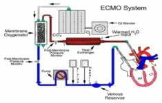 What is ECMO Machine and how to work, best procedure, benefit1