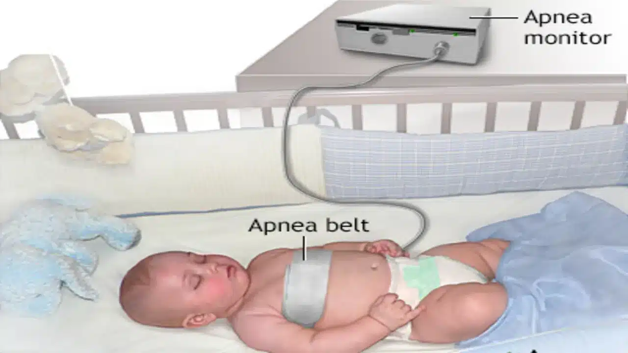 What is Apnea Monitor: Best Procedure AR Medical Technology 24