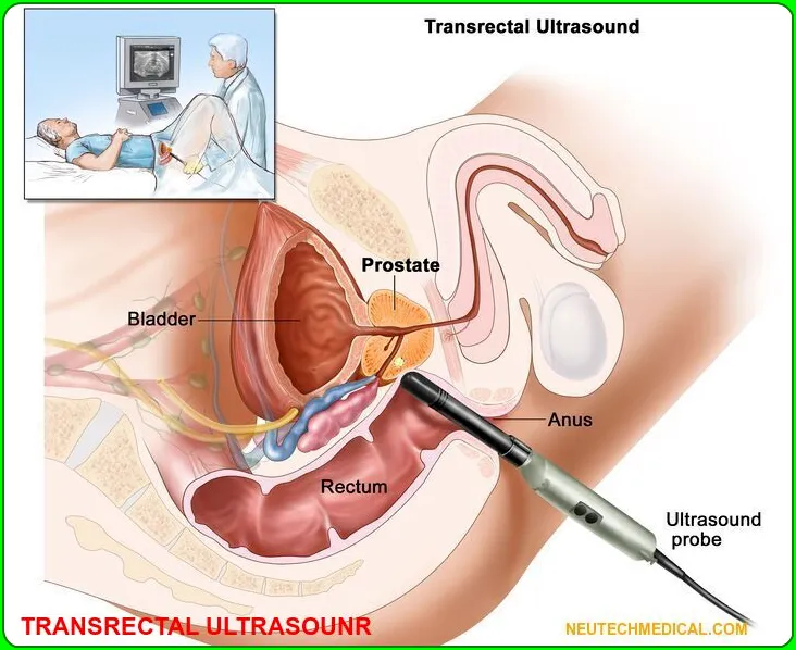 What is ultrasound and it's Function1