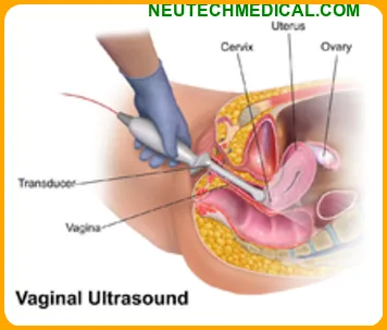 What is ultrasound and it's Function1
