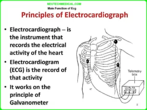 Electrocardiogram ECG
