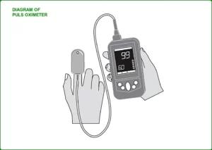 What is pulse oximeter
