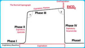 What is Capnography How to Capnography work