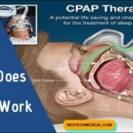 What is the CPAP Machine