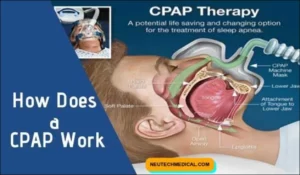 What is the CPAP Machine