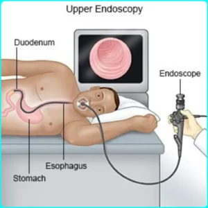 What is an endoscopy, endoscopy work , endoscope uses