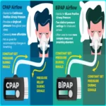 What is BIPAP?