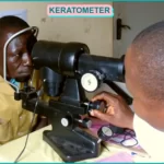 keratometer, keratometry,manual keratometer, what is keratometer, What is Keratometry