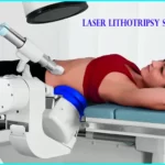 What is Lithotripsy, how to work lithrotripsy