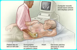 What is an echocardiogram