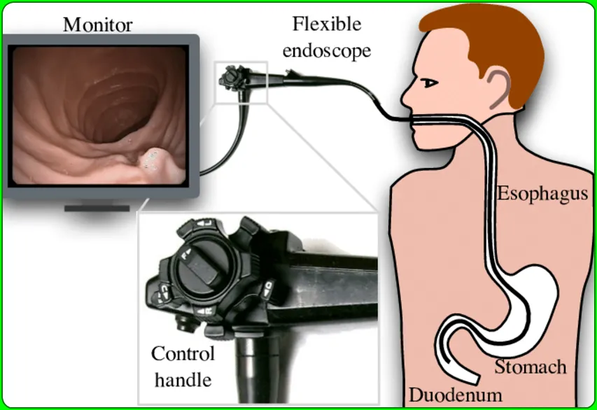 What is gastroscopy