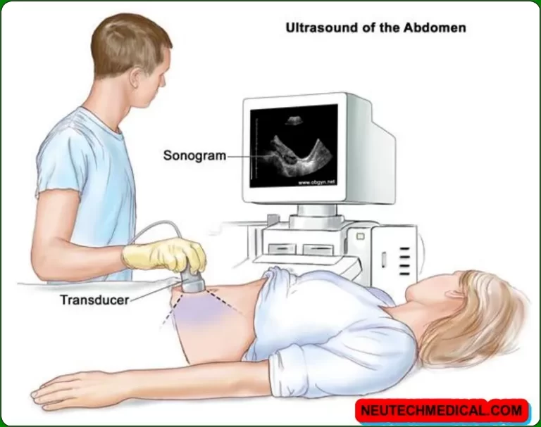 3d ultrasound, 3d ultrasound near me usa, hair on 3d ultrasound, down syndrome 3d ultrasound 20 weeks,