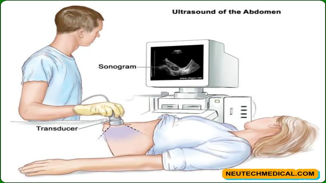 Is sonography done empty stomach?