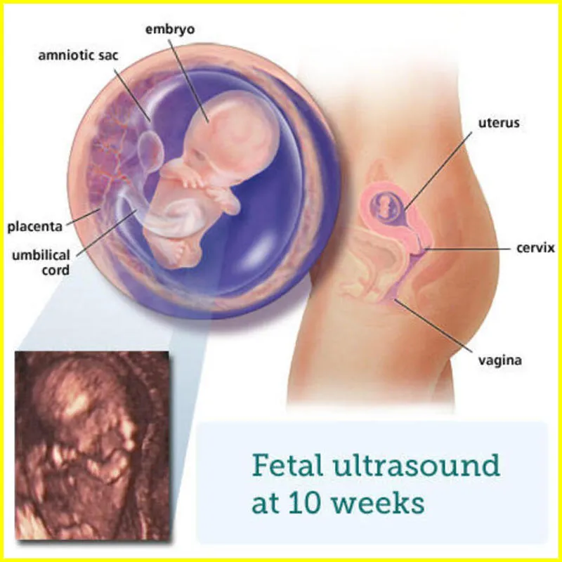 10 Week Ultrasound: What It Would Look Like Best Parents