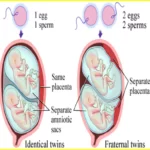 5 week twin pregnancy ultrasound