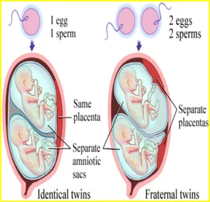 5 week twin pregnancy ultrasound