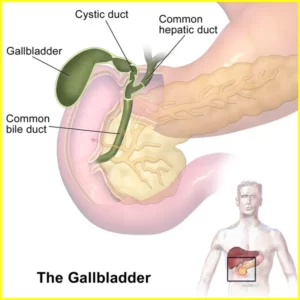 Abnormal Gallbladder Ultrasound