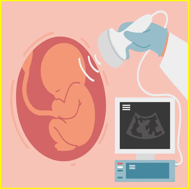 Baby Ultrasound, 3d Baby Ultrasound, 4d Baby Ultrasound, Baby Ultrasound Pictures, Baby Ultrasound Near Me.