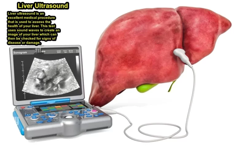 What type of ultrasound is a liver ultrasound?