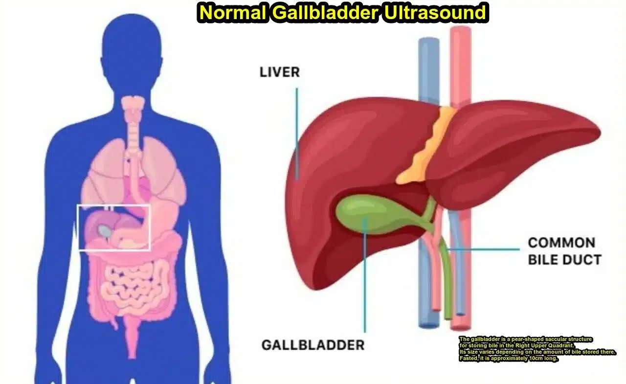 What is normal gallbladder ultrasound report?