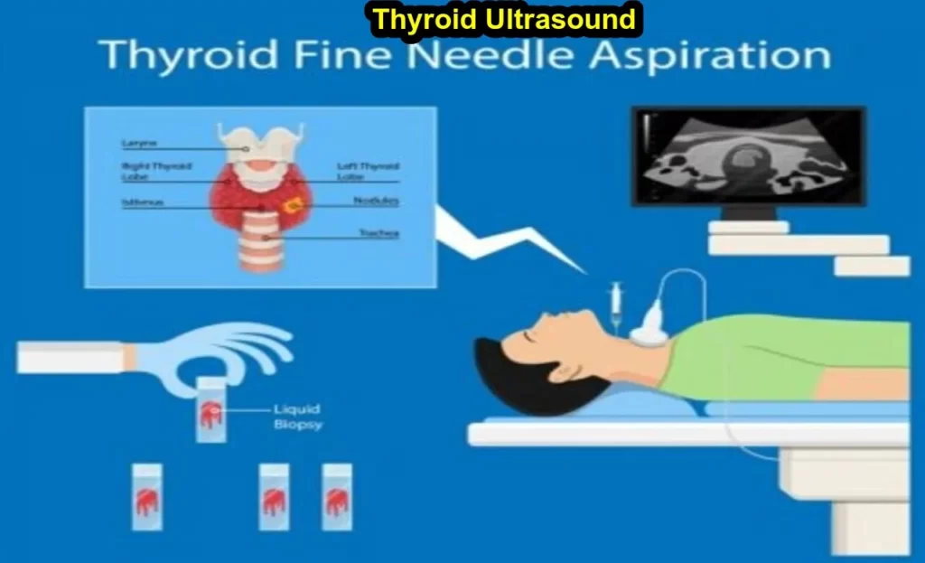 What is the cost of thyroid scan?
