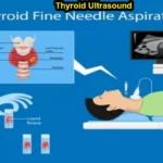 What is the cost of thyroid scan?