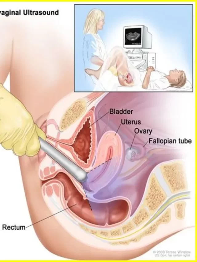 Normal vs Abnormal Pelvic Ultrasound: What it is, sign
