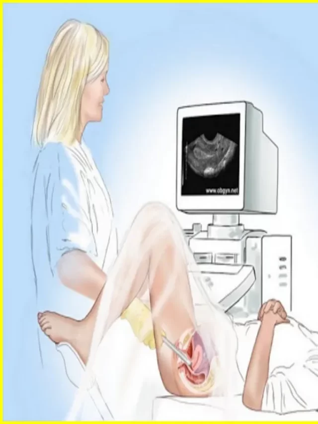What To Expect Vaginal Ultrasound