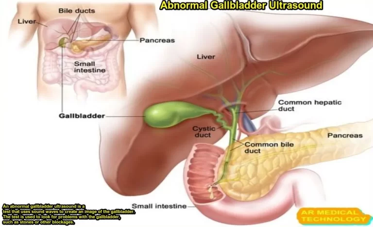Abnormal Gallbladder Ultrasound