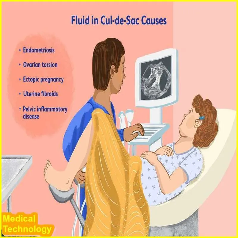 Pelvic Ultrasound: How to Work, What Is It and Working Principle Best Benefit and Risk 24