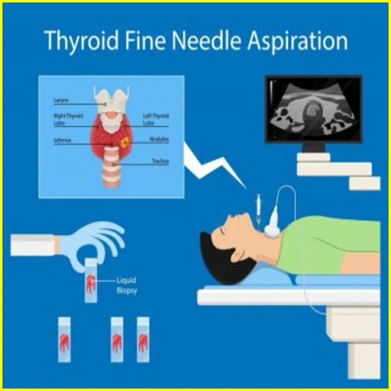 Thyroid Ultrasound, nodules on Thyroid Ultrasound, Abnormal Thyroid Ultrasound, Thyroid Cancer Normal vs Abnormal Thyroid Ultrasound.