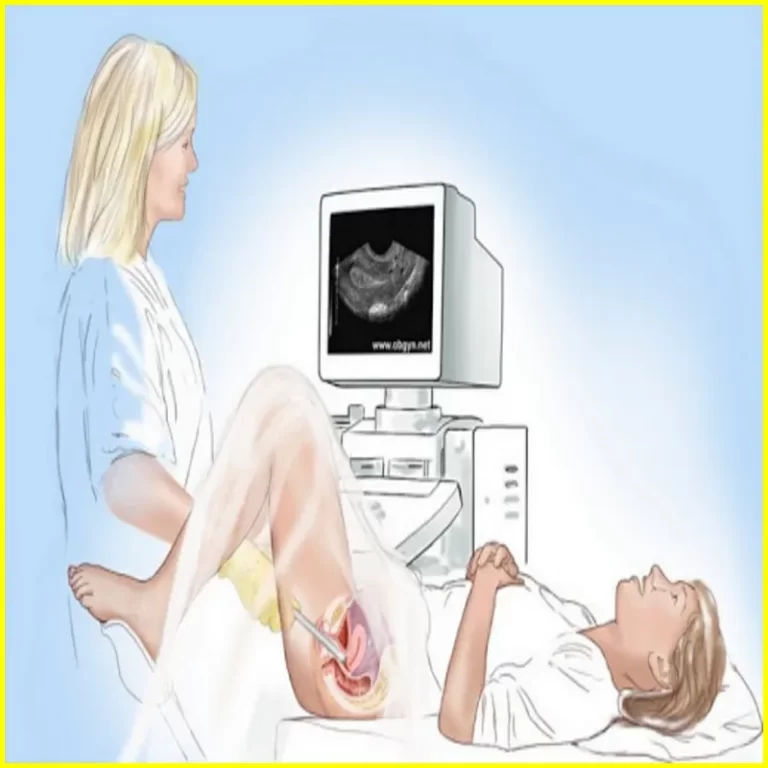 Vaginal Ultrasound, Vaginal Ultrasound Tool, Vaginal Ultrasound Pregnancy, What is a Vaginal Ultrasound. Trans Vaginal Ultrasound.