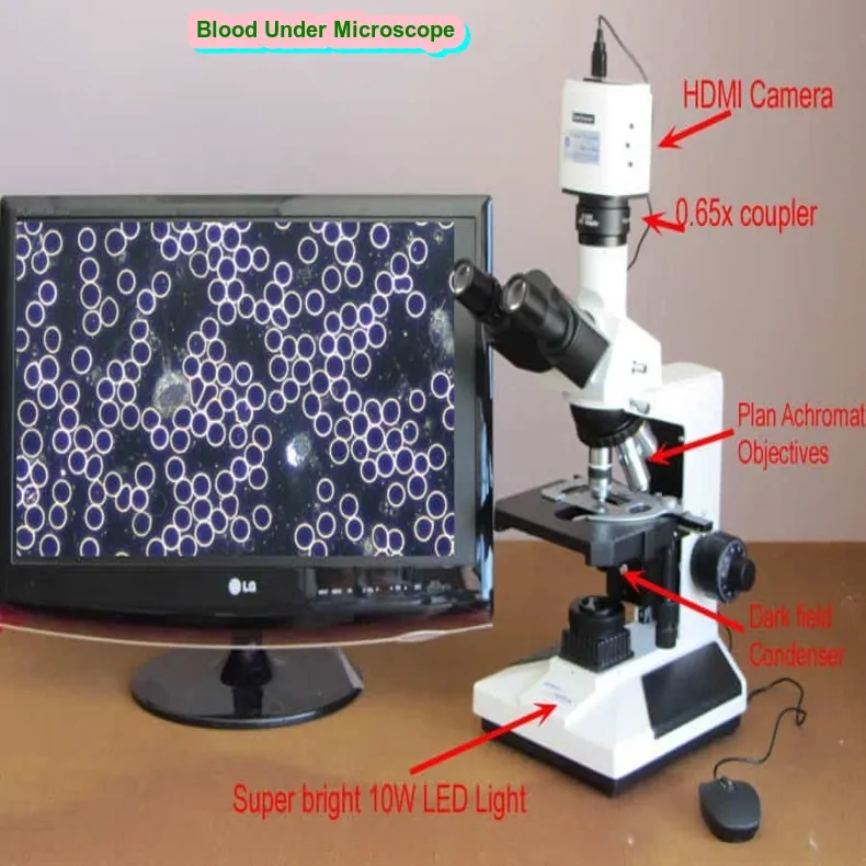 Blood under microscope Article About:- Medical Technology Article About:- IR News Article About:-Amazon Product Review