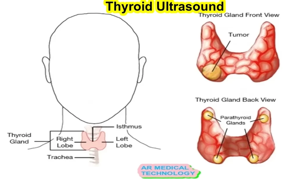 thyroid ultrasound images
