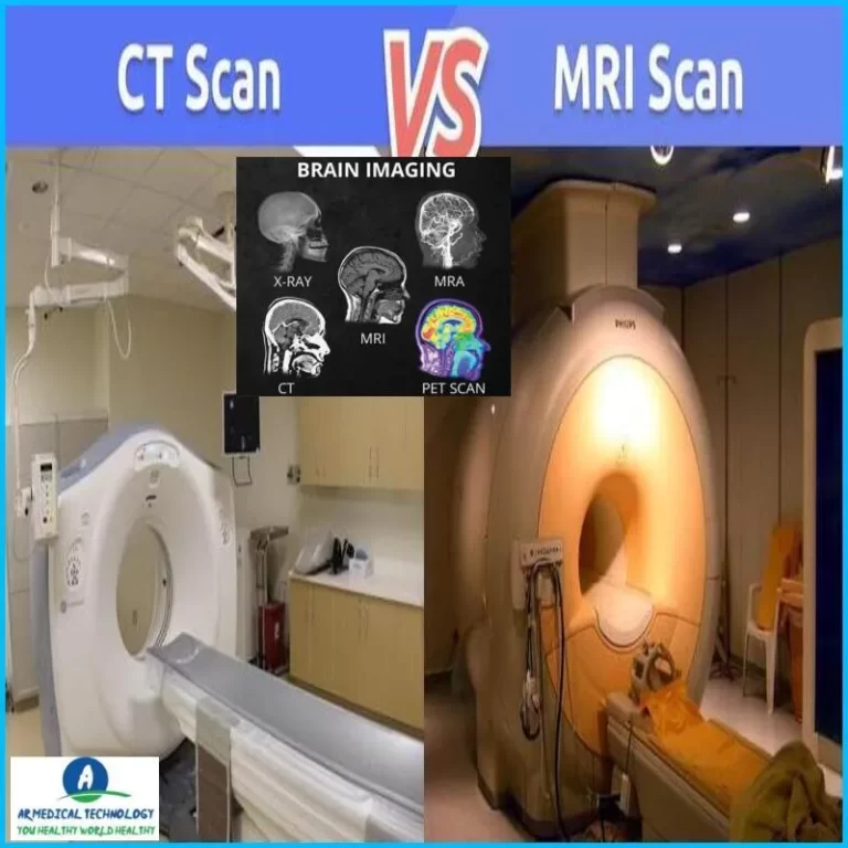 ct scan vs mri