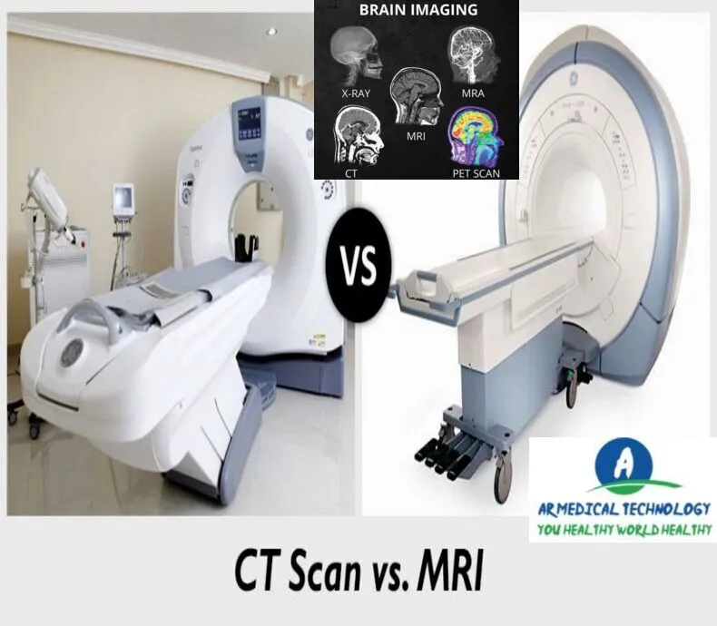 MRI Vs CT Scan