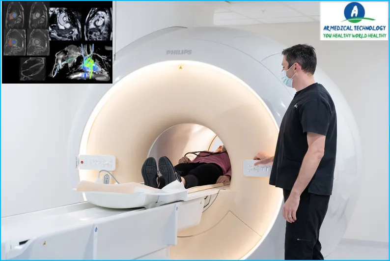 What is a cardiac mri Purpose, Best Procedure, and Risks 24