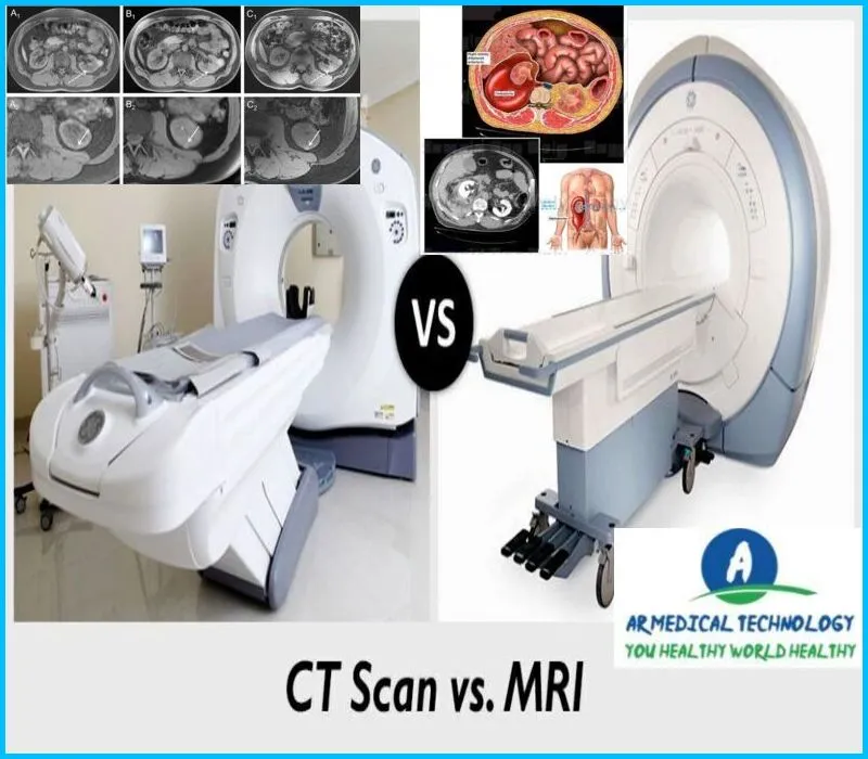 ct scan vs mri for abdomen