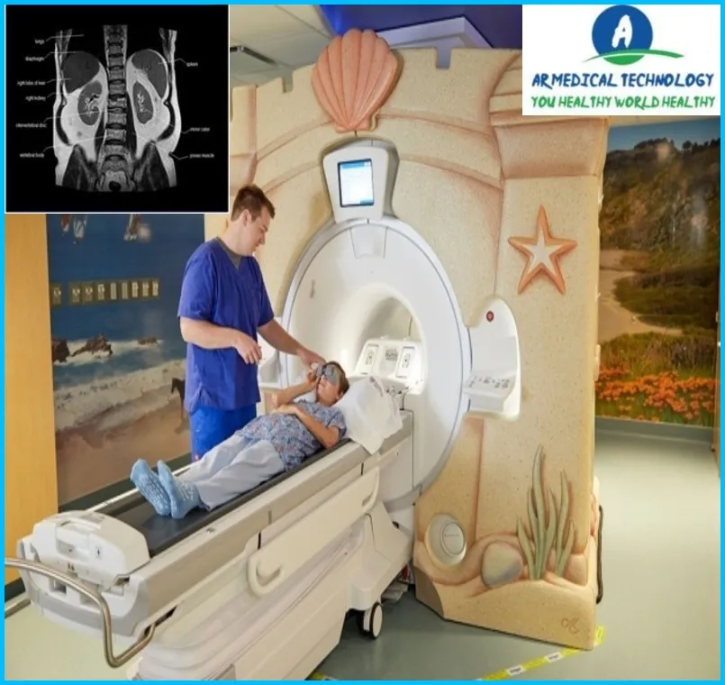 How Long Does an MRI Take Abdomen