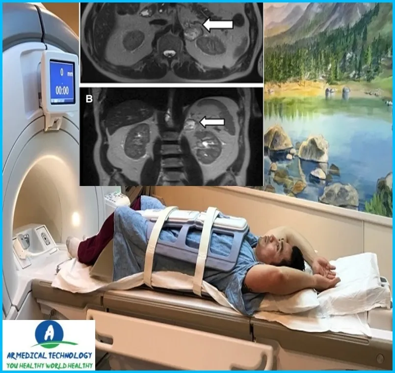 How Long Does an MRI Take Abdomen 24 AR Medical Technology