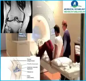 How Long does an MRI Take Knee