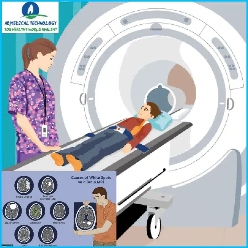 Migraine White Spots on Brain MRI: Migraine and Brain Lesions 23-AR MEDICAL TECHNOLOGY