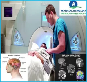 MRI Vs CT Scan Brain
