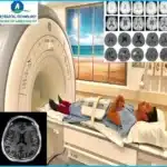 Normal Brain MRI Images