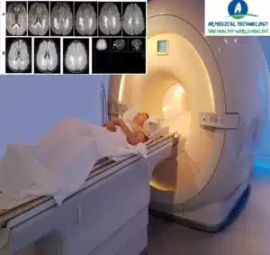 Normal White Spots on Brain MRI