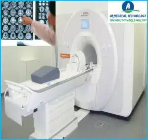 White Spots on Brain MRI Headaches