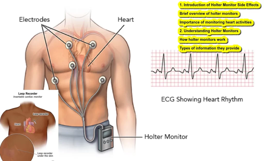 Holter Monitor Side Effects