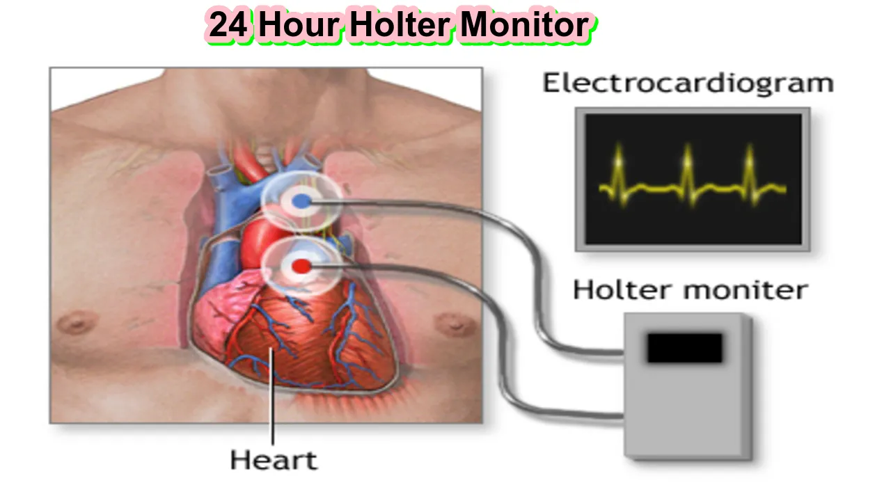 24 Hour Holter Monitor: How to Work, Best Benifit and Risk and How to Prepare