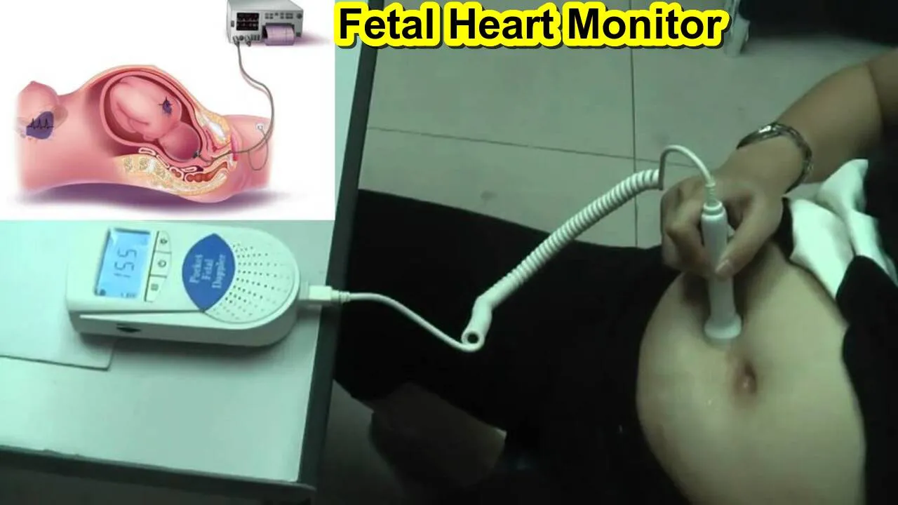 How to Use a Fetal Heart Monitor? Types, Best Setting Up the Fetal Heart Monitor 24